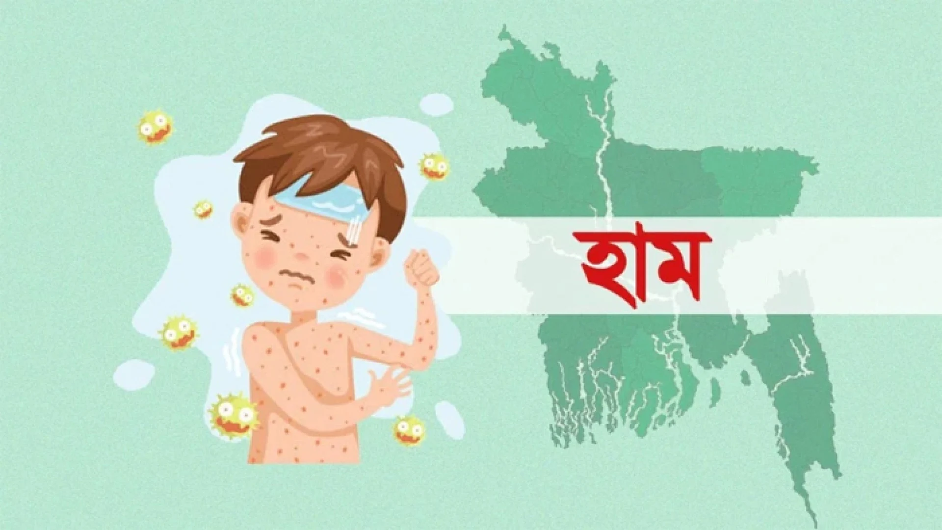 হাম ও হামের উপসর্গে  আরও ৭ শিশুর মৃত্যু