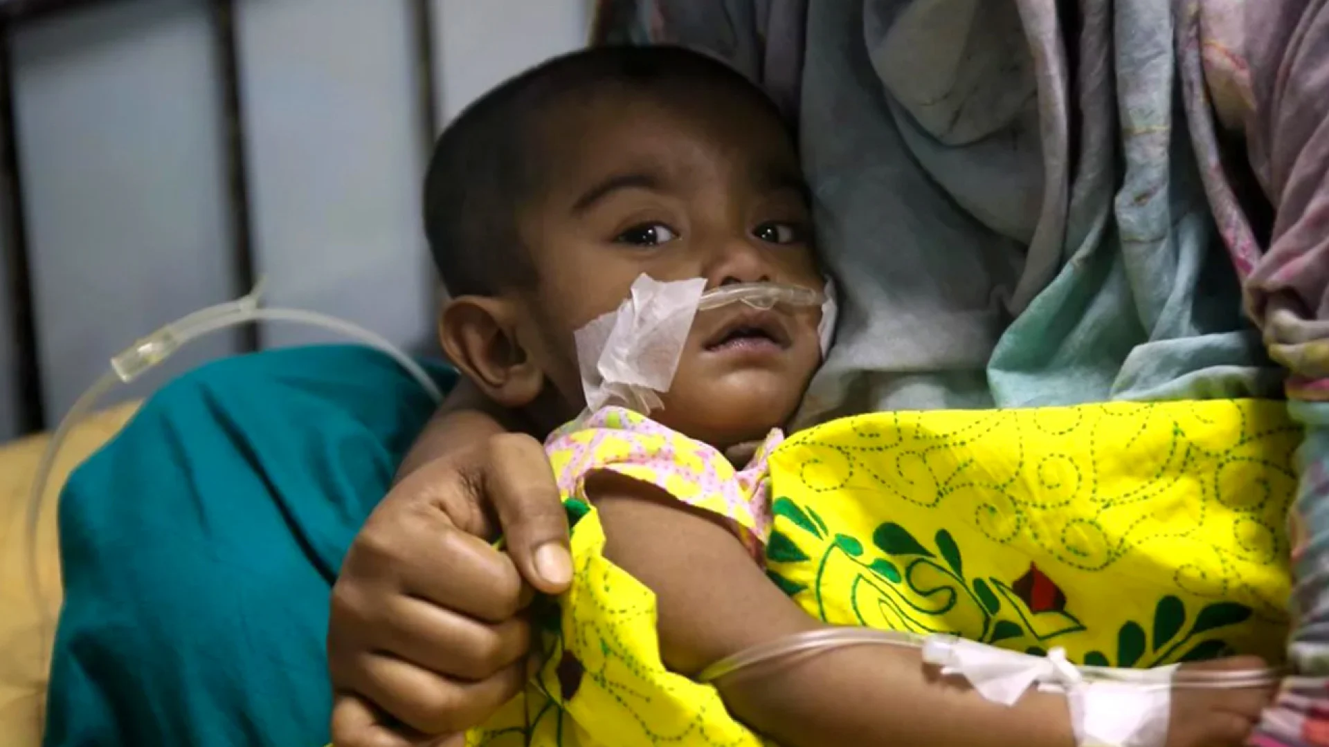 হামের উপসর্গে আরও ৩ শিশুর মৃত্যু, আক্রান্ত ৯০৪