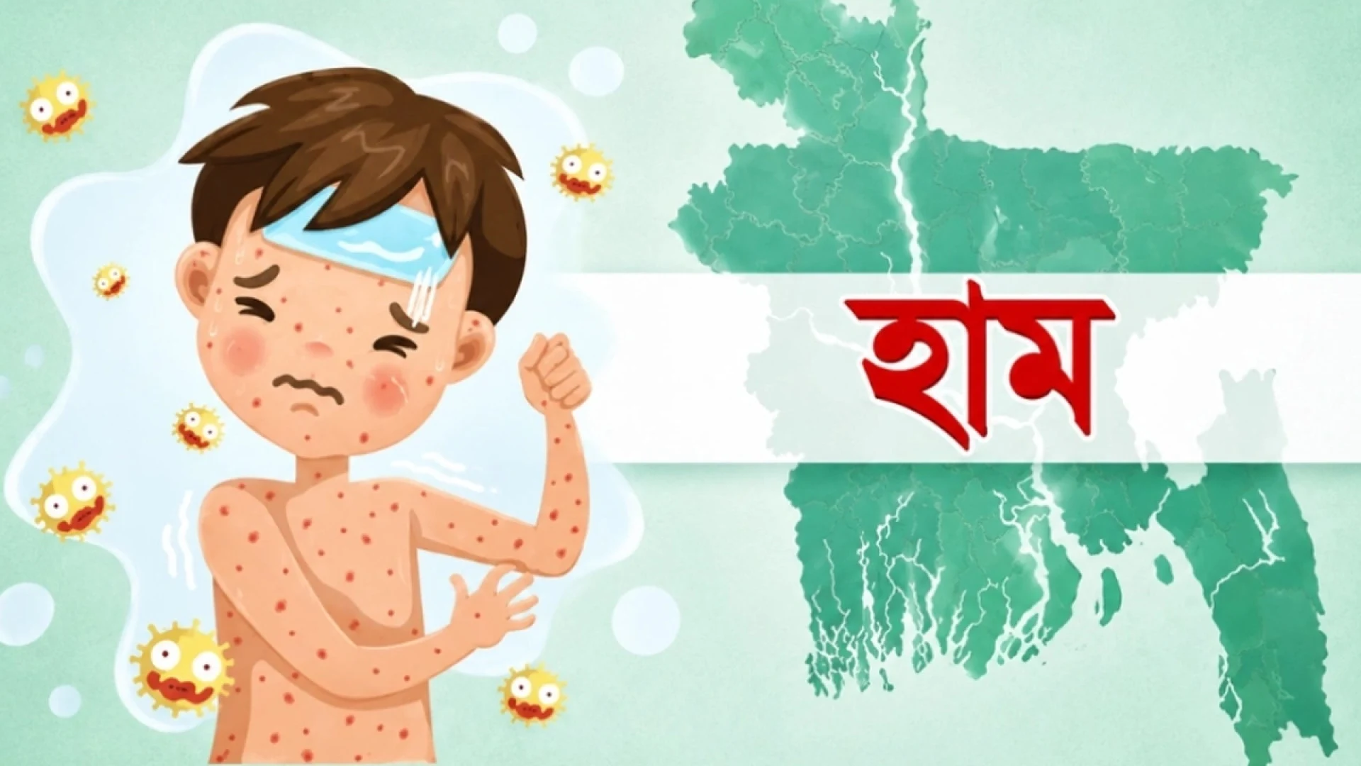  হামের উপসর্গে ২৪ ঘণ্টায় আরও ৫ শিশুর মৃত্যু, আক্রান্ত ১,০৭৭